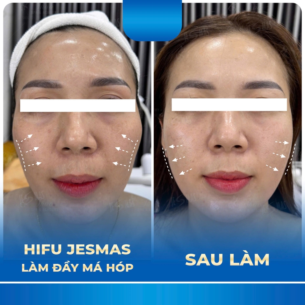 hifulamdaymahopxanhdam