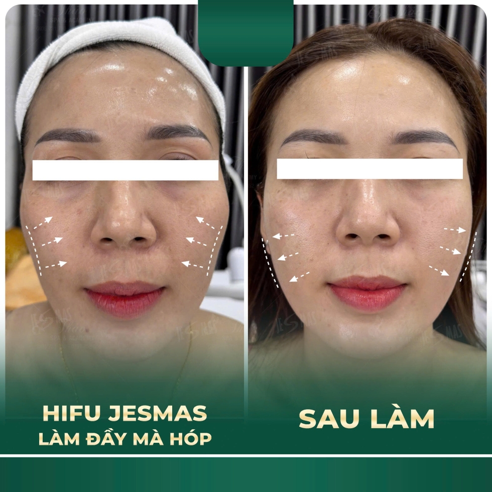 hifulamdaymahopxanhdam2
