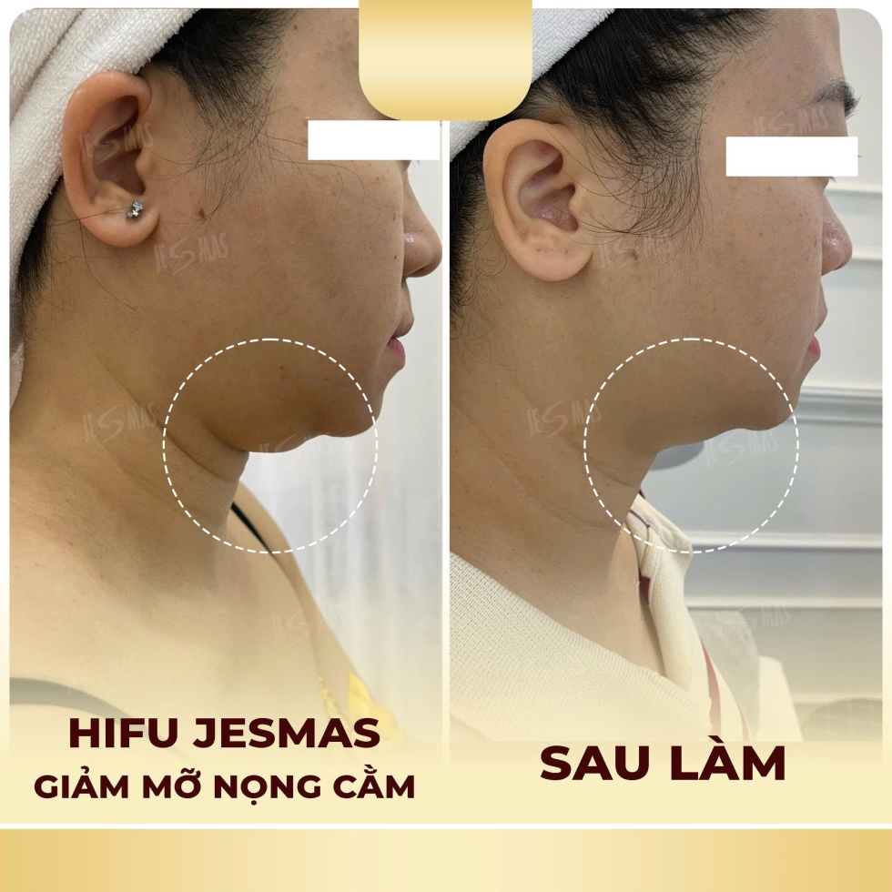 hifugiammonongcamvang