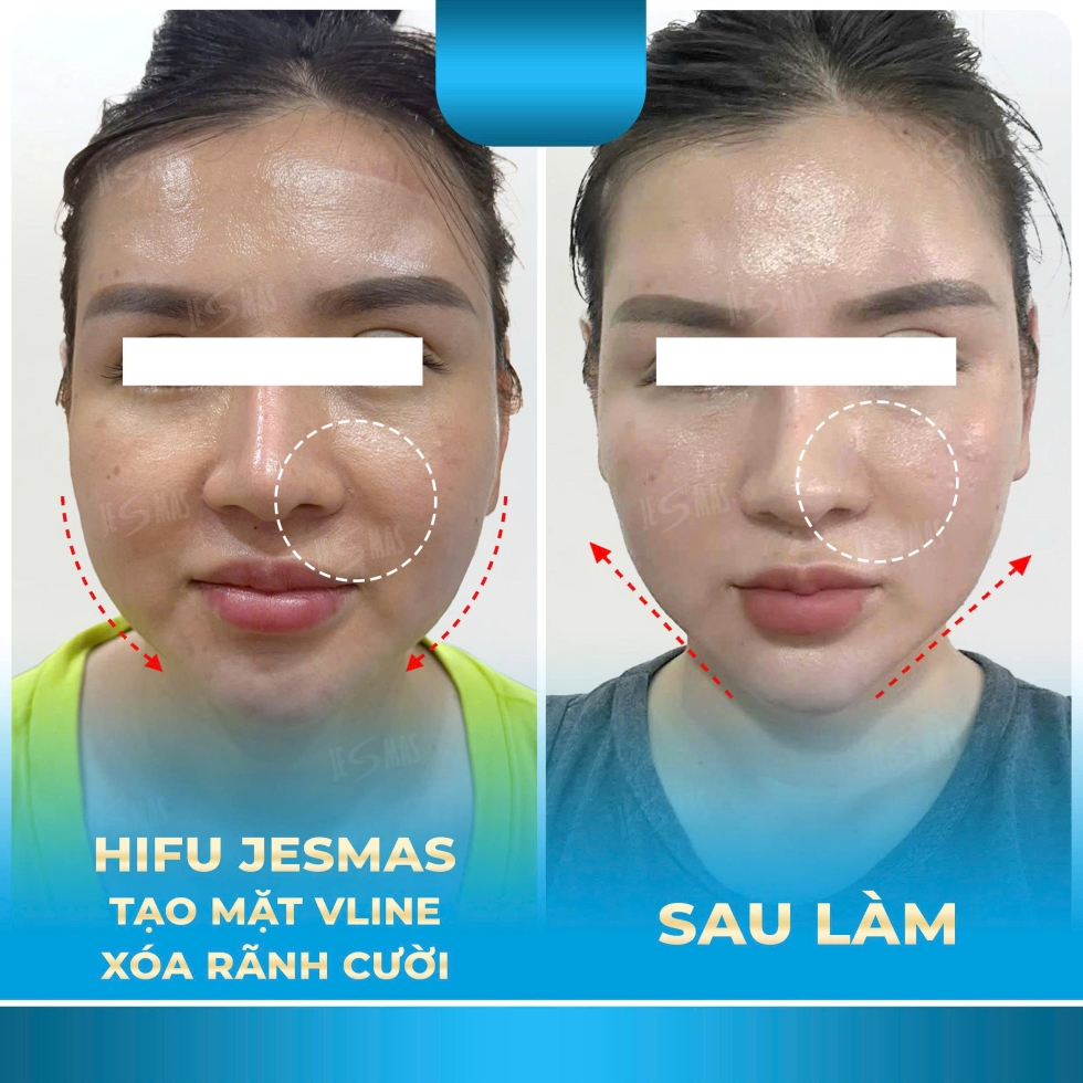 taomatvlinexoaranhcuoixanhnhat