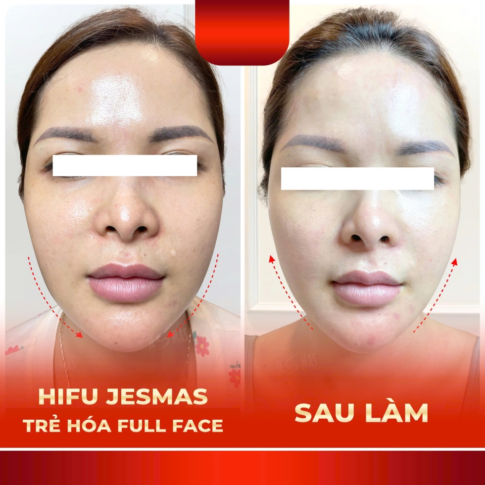 hifujesmastrehoafullfacedo
