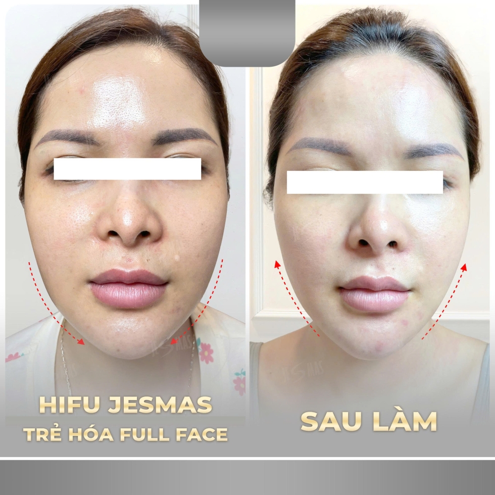 hifujesmastrehoafullfacexam