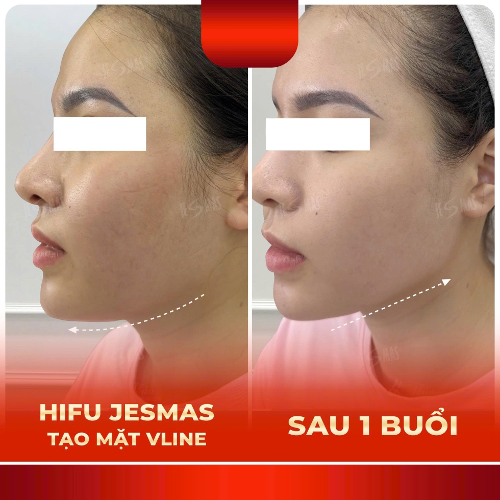 hifitaomatvlinedo