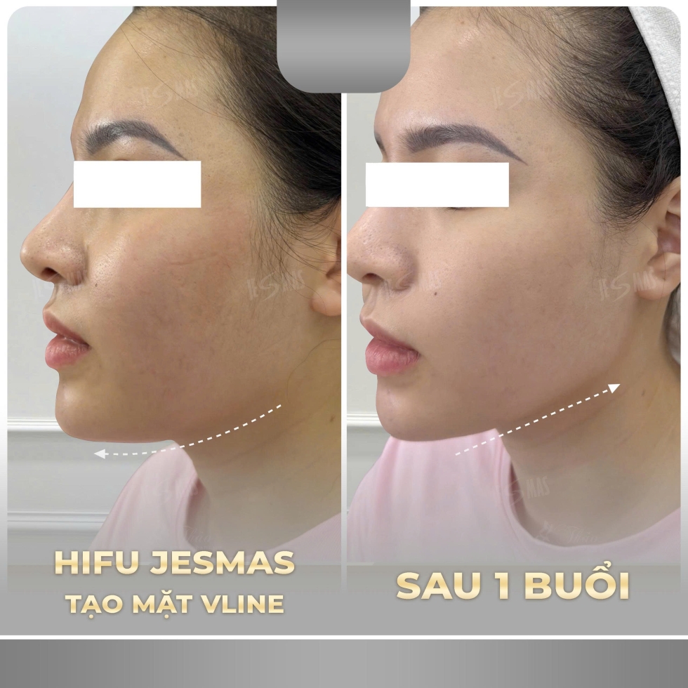 hifitaomatvlinexam