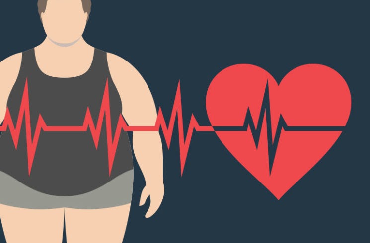 Cảnh báo béo phì gây nguy cơ bệnh tim mạch