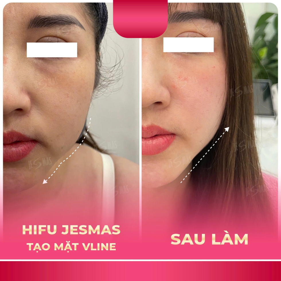 taomatvlinehong