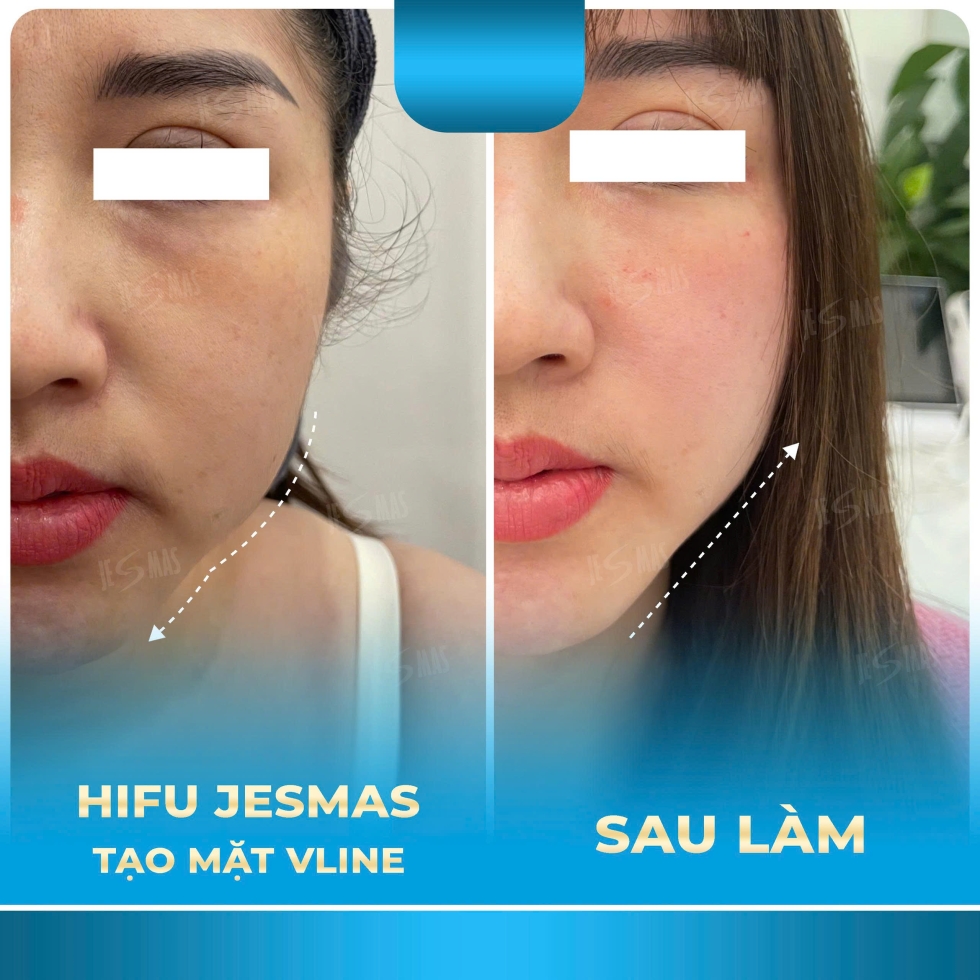 taomatvlinexanhnhat