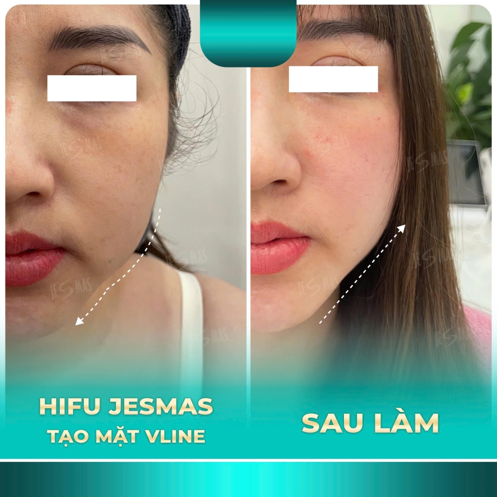 taomatvlinexanhnhat2