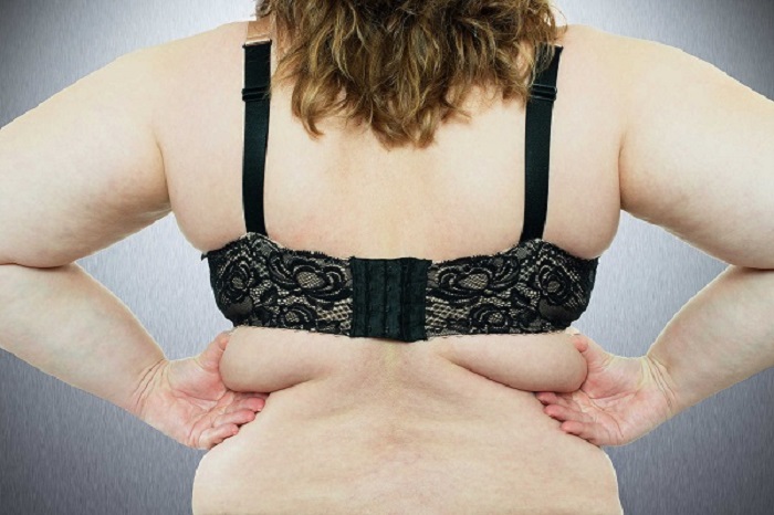 Giải pháp giảm béo hiệu quả cho từng dạng mỡ trong cơ thể